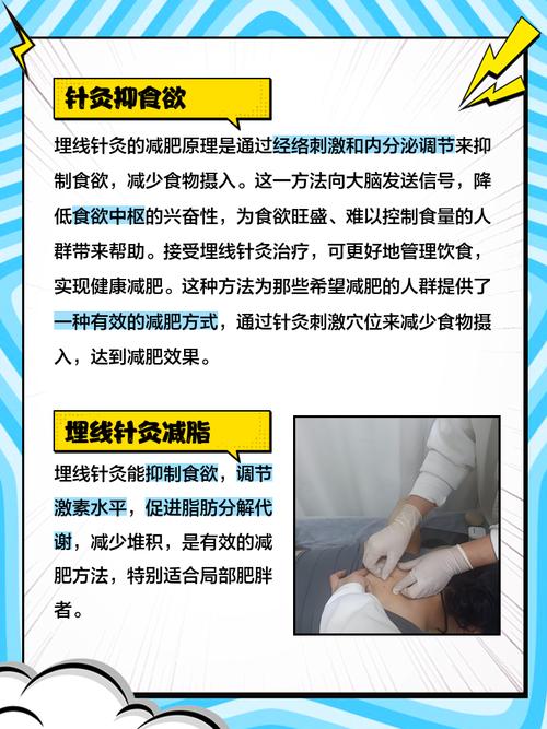 针灸埋线好还是针灸好