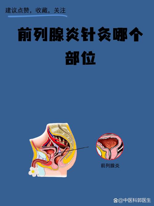 针灸治前列腺炎怎么样