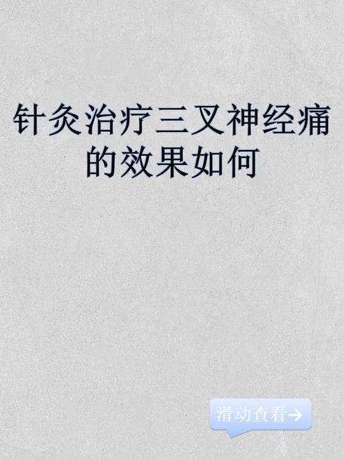 三叉神经痛可以针灸吗