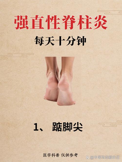 强直性脊柱炎不要针灸