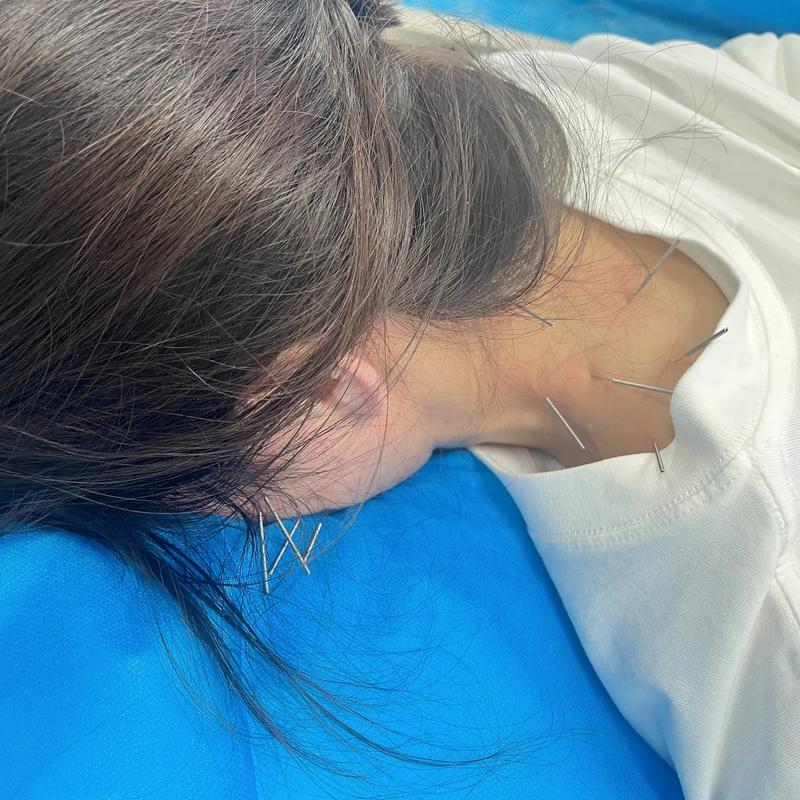 颞颌关节炎针灸有用吗