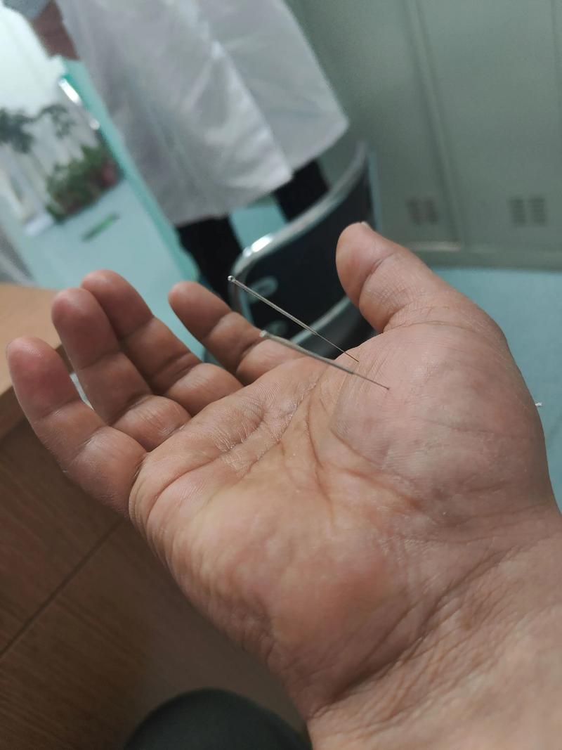 针灸扎的针越多越好吗