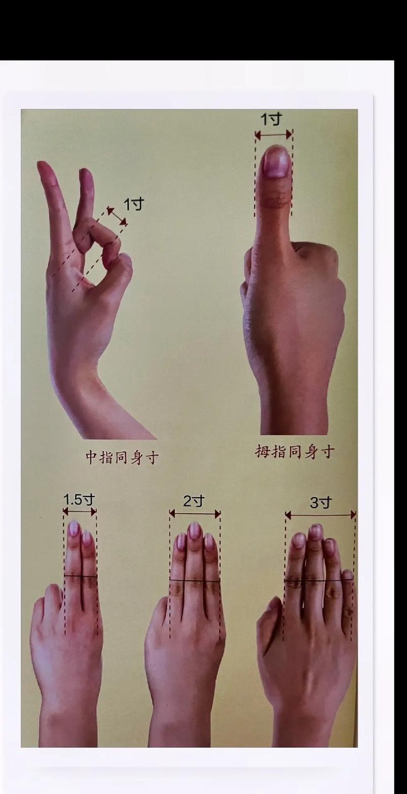 针灸针一寸是多少厘米