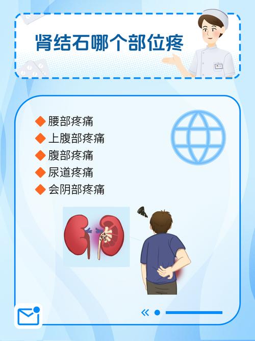 有肾结石的痛风怎么办