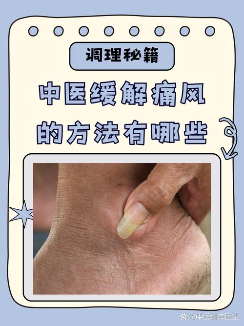 痛风性关节炎中医诊断