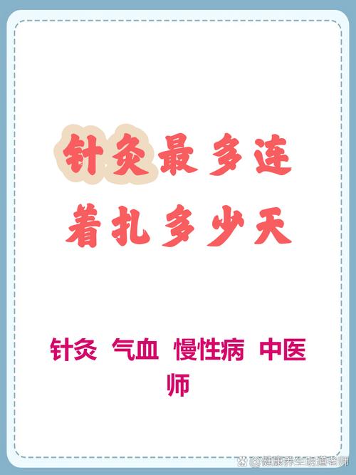 针灸连续扎多长时间好