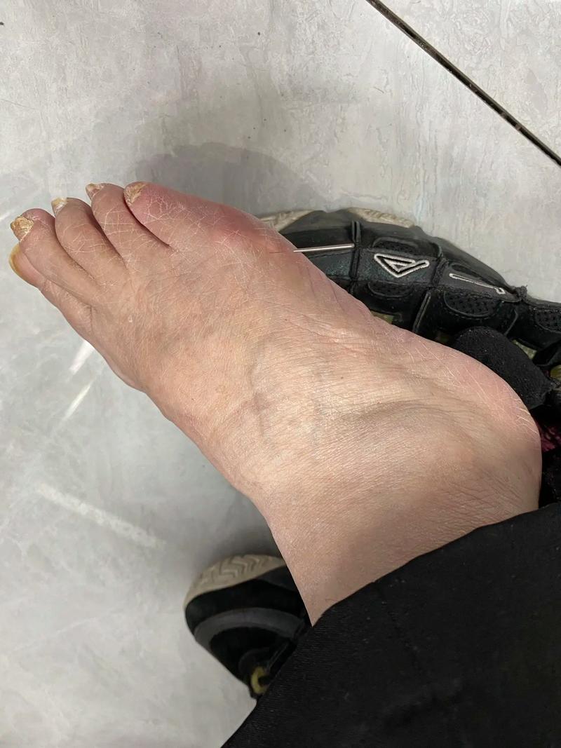 张氏神针灸效果怎么样