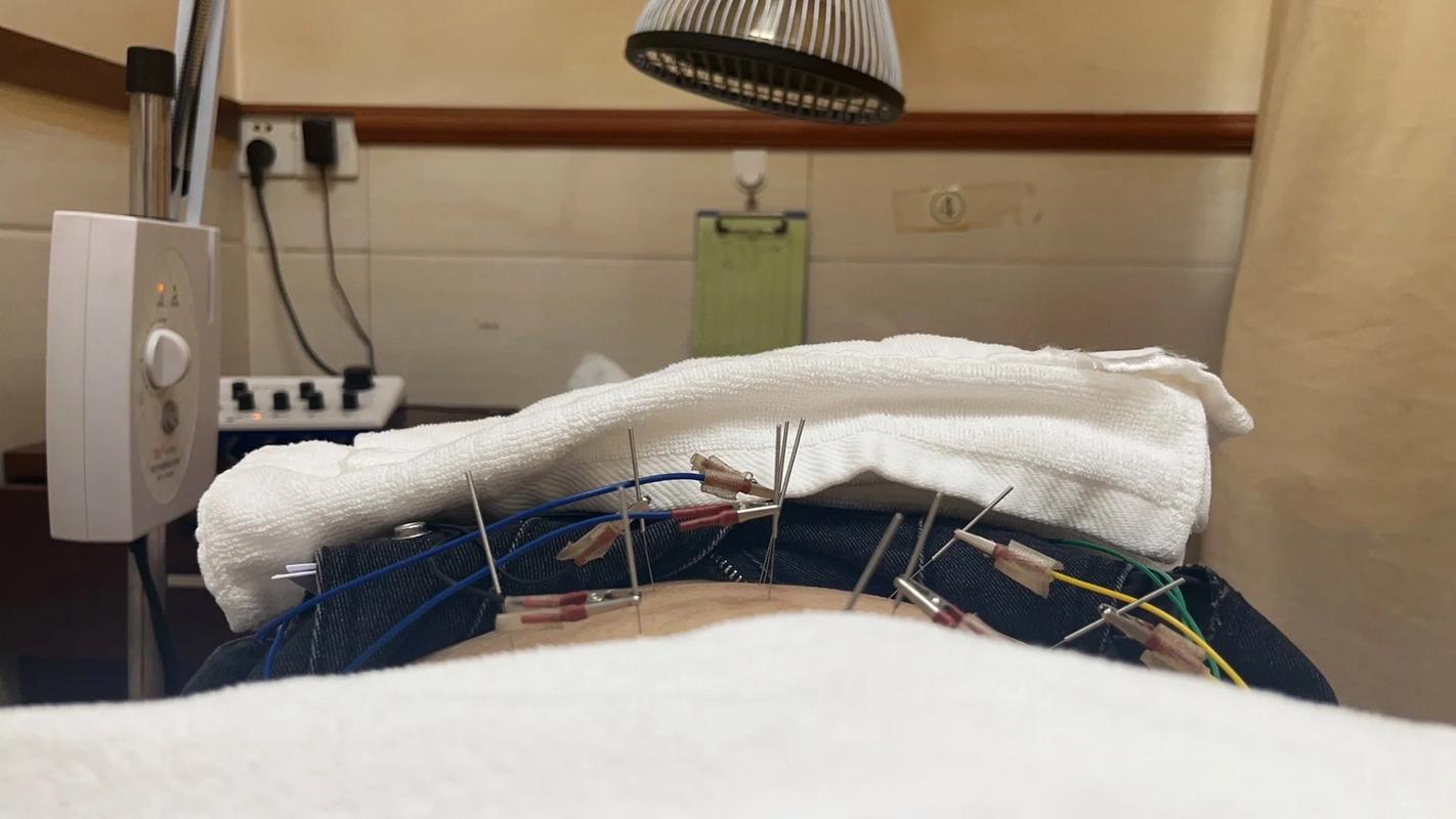 月经期痛经能扎针灸吗