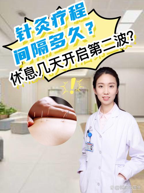 针灸的疗程是多长时间