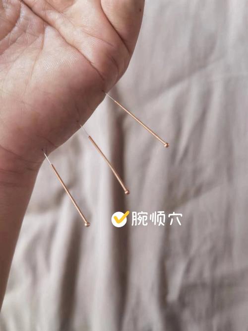 成都董氏针灸真的假的