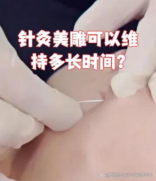 针灸美雕有科学依据吗