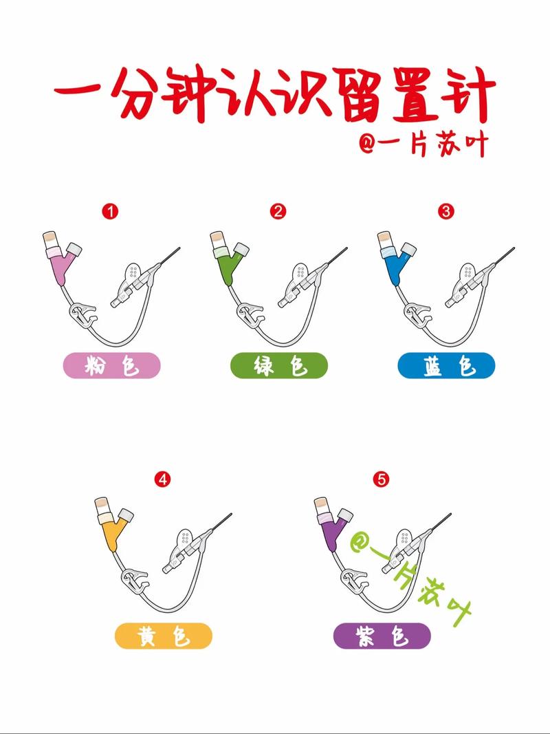 针灸快针与留针的区别