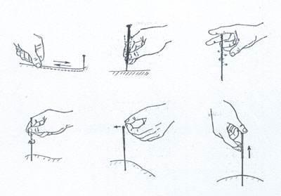 针灸快针与留针的区别