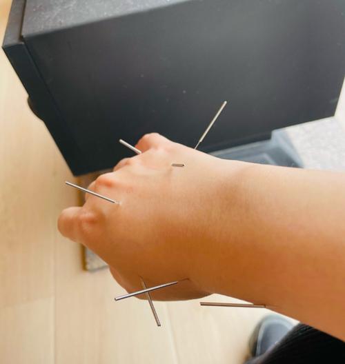 针灸治疗颈椎病靠谱么