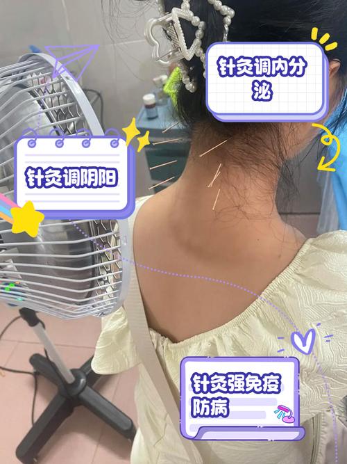 年轻人针灸对身体好吗