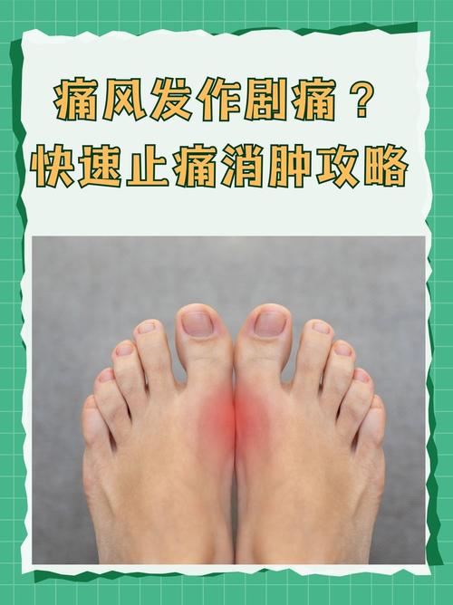 痛风不痛了但是不消肿