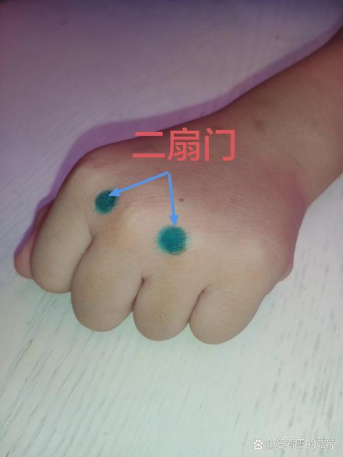 针灸治感冒效果怎么样