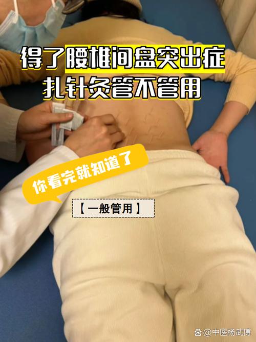 腰椎间盘突出针灸部位