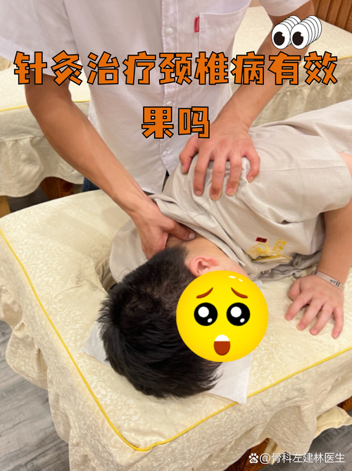 针灸颈椎会有后遗症吗