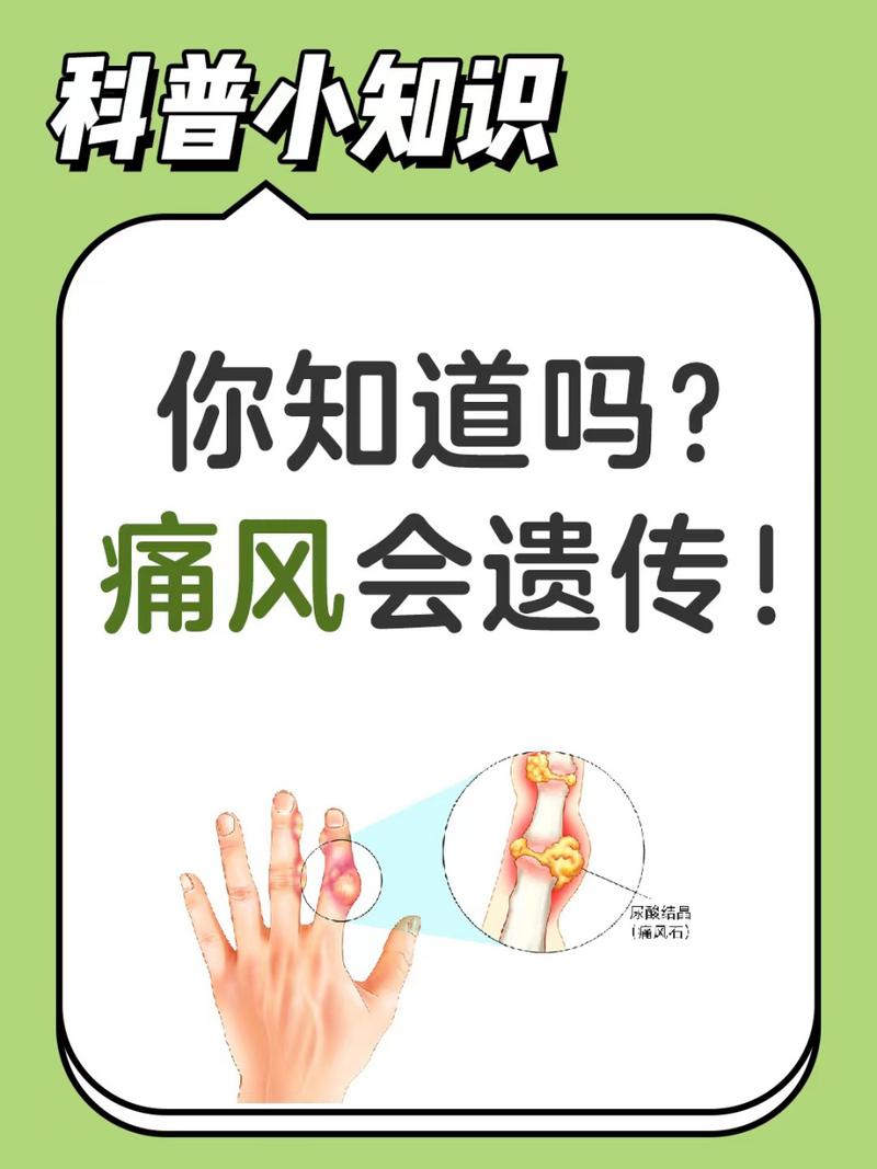 痛风遗传的几率有多大