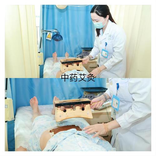 针灸对卵泡生长有用吗