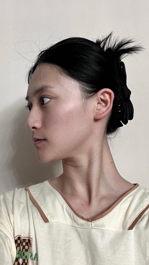 针灸隆鼻的效果好不好