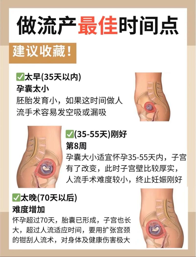 哪个妇科医院流产安全