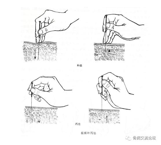 针灸捻转补泻手法图解