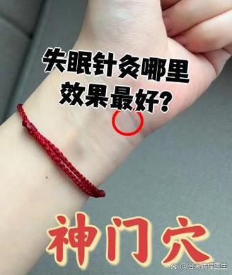 针灸治疗失眠见效快吗