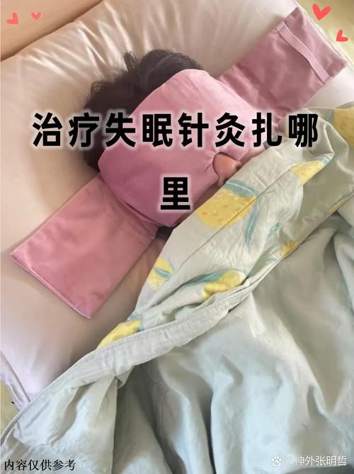 针灸治疗失眠见效快吗