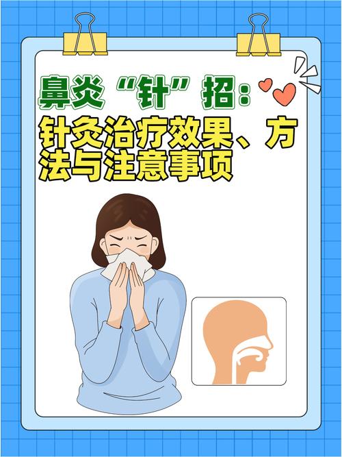 过敏性鼻炎针灸能好吗