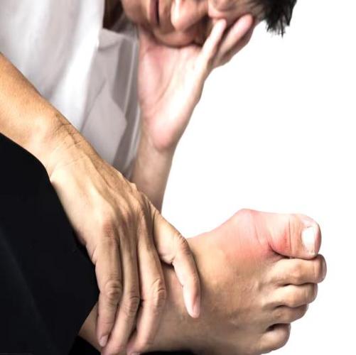 西安第五医院治疗痛风