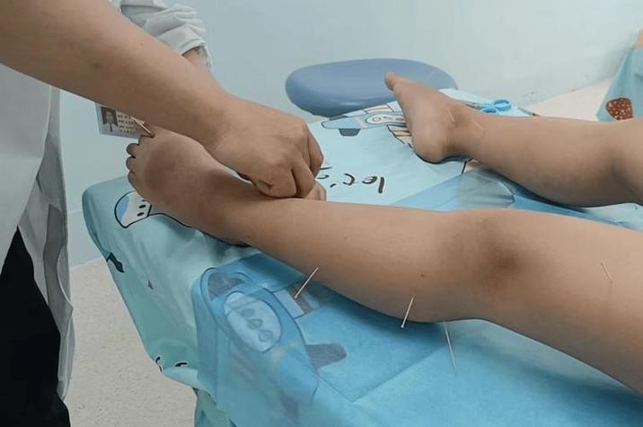 尿床针灸有效果怎么样