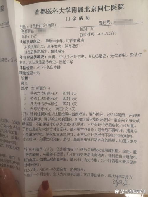 针灸治好鼻窦炎的病例