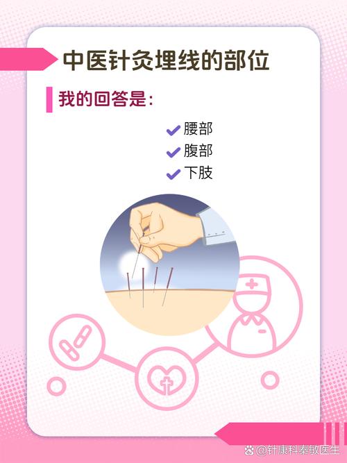 中医针灸埋线的副作用