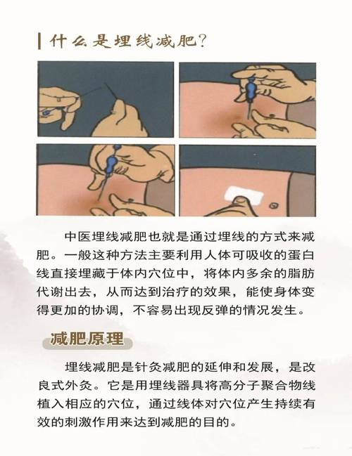 中医针灸埋线的副作用