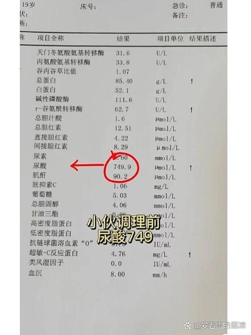 尿酸700多没有痛风