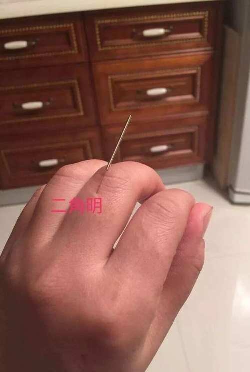 呃逆针灸治疗一针疗法