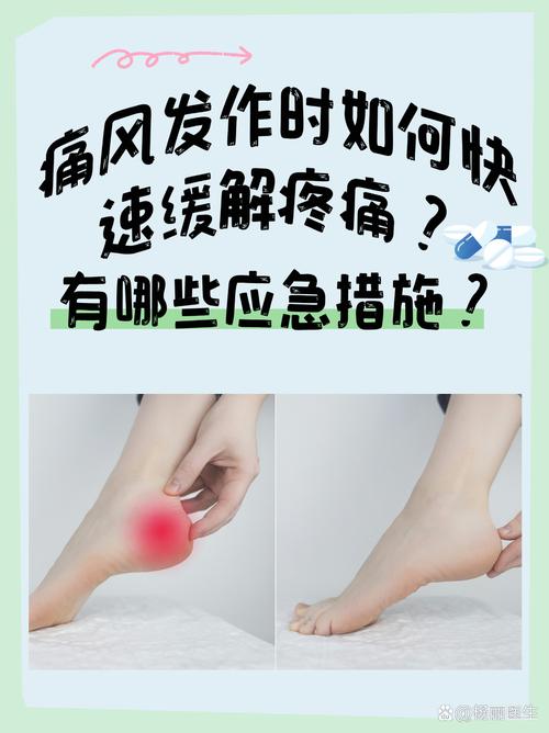 痛风发作时是怎么疼的