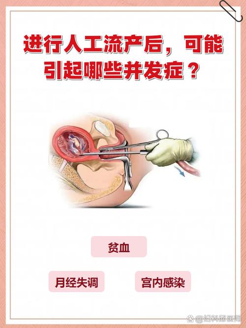 最安全的妇科医院流产