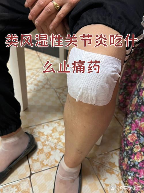 大黄碳酸氢钠片 痛风