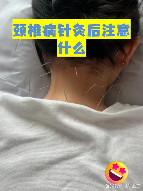 颈椎针灸后酸疼怎么办