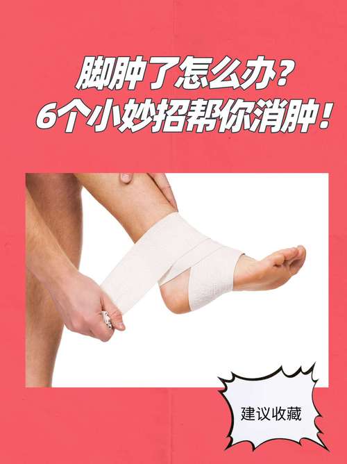 痛风脚肿如何消肿止痛