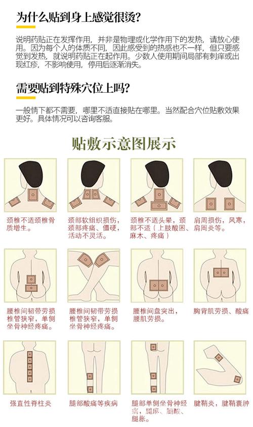 黄土蜂针灸痛可贴效果