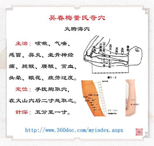 针灸子宫脱垂会根除吗