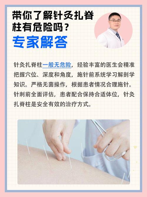 助理医师可以扎针灸吗