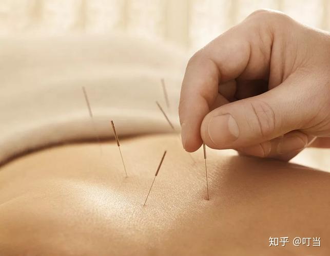 针灸促排卵扎什么位置