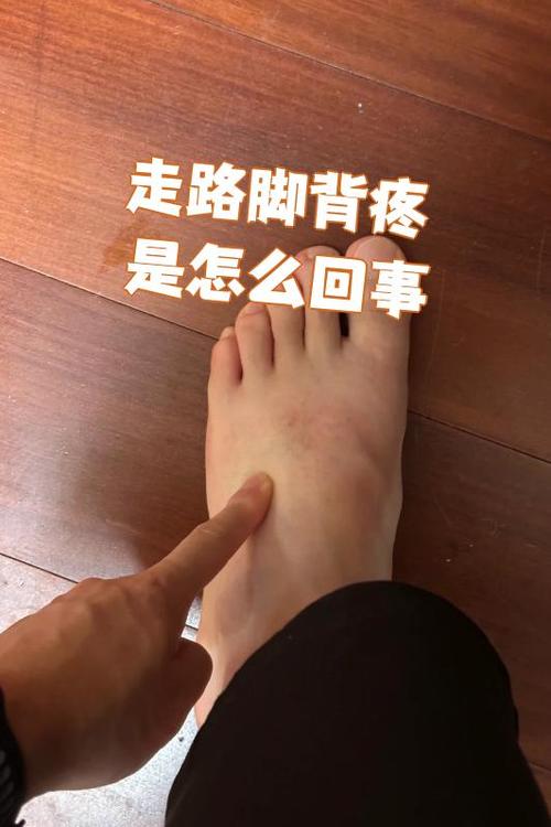 痛风好了左脚又痛右脚