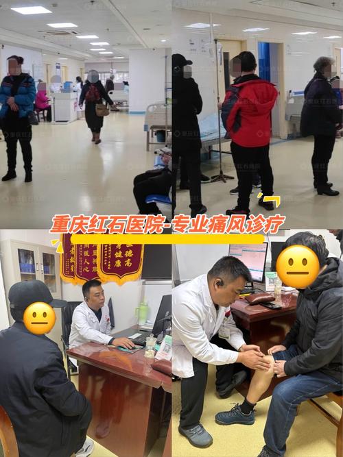 治疗痛风重庆九五真优
