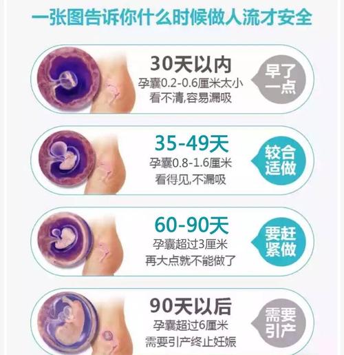 哪种人流最安全最安全